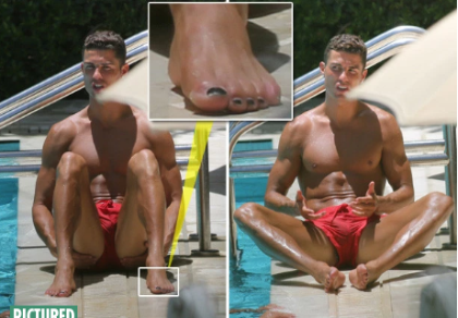 Ronaldo lại lộ ảnh… sơn móng chân
