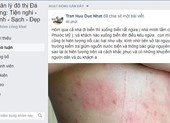 Dân Đà Nẵng lo lắng khi cứ tắm biển là ngứa