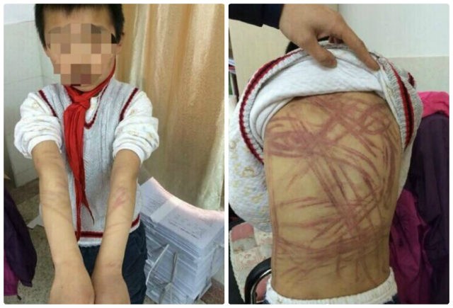 Đánh con nuôi dã man vì không hoàn thành bài tập - ảnh 1