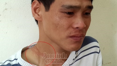 “Ngáo đá” và những hành vi cuồng loạn - ảnh 4