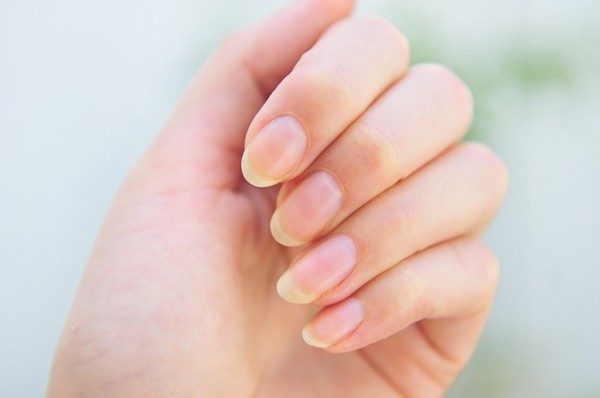 6 dấu hiệu khắp cơ thể báo động stress - ảnh 2