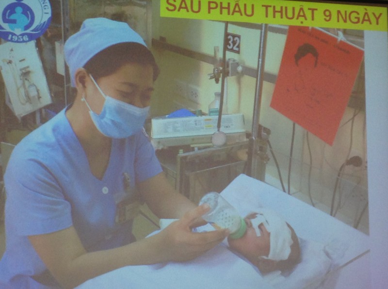 Bé sơ sinh bị đâm vào đầu đã hồi phục ngoạn mục - ảnh 2