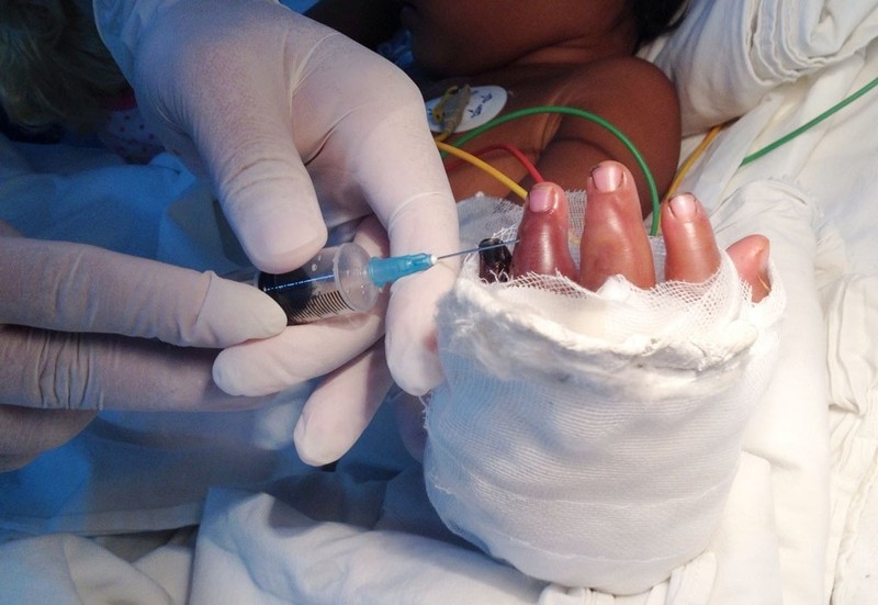 Bé 2 tuổi theo mẹ đi làm bị xích máy cắt gạch cắt lìa bàn tay - ảnh 2