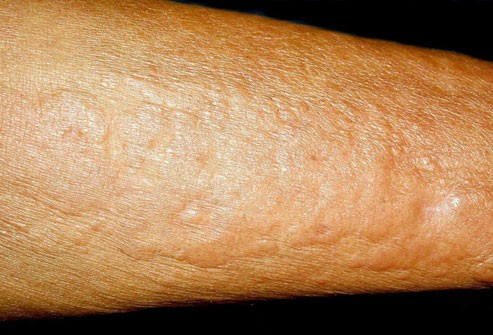 10 điều làn da 'mách' về sức khỏe của bạn - ảnh 7