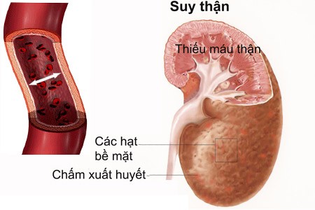 Ai không nên dùng thuốc pantoprazol? - ảnh 1