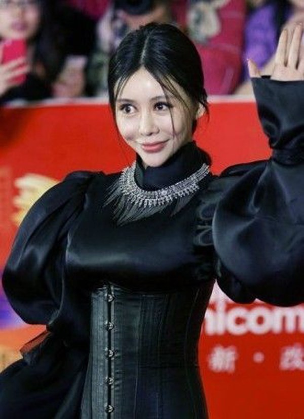 Hàng vạn người tàn phế vì giải phẫu thẩm mỹ - ảnh 2