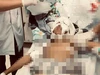 Chơi gần nhà, bé trai 11 tuổi bị chó Becgie cắn nhập viện cấp cứu