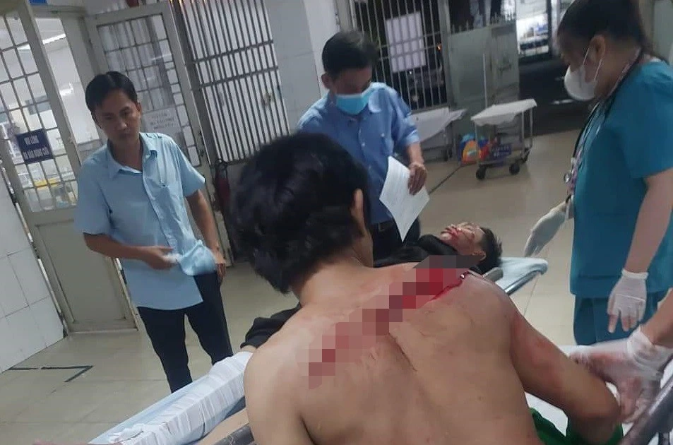 Binh Duong: A young man boldly used a knife to slash a tech driver who robbed a motorbike