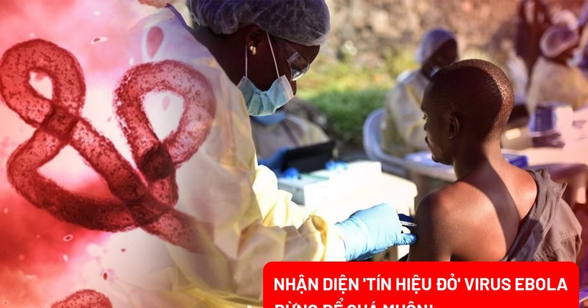 Những lưu ý không thể bỏ qua