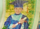 Bé trai 13 tuổi tử vong vì bị gãy xương nhưng mổ ruột thừa?