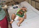 Trong nửa tháng, một gia đình mất hai con vì bệnh whitmore