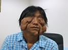 U 'quái' làm chàng trai khổ sở suốt 17 năm ròng