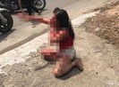 Phẫn nộ: Cô gái bị người tình cũ rạch mặt tàn ác
