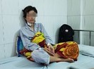 Người đàn ông cắt tai, hành hạ vợ cũ dã man
