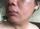 1 nhà báo bị đánh ở quận 9