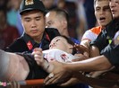 Công an vào cuộc vụ bắn pháo sáng khiến nữ CĐV bỏng nặng