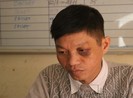 1 CSGT bị người vi phạm tông xe, tấn công