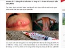 Đừng nói về HIV theo kiểu hù dọa nữa!
