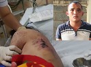 Chủ quán cà phê kích dục đánh tiếp viên nhập viện