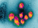 Virus corona: Không chặn được lây lan không kiểm soát nổi dịch