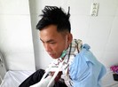 Một bảo vệ rừng bị chém đứt gân tay
