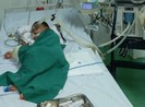 Chọc tổ ong vò vẽ, bé 4 tuổi bị đốt hơn 80 mũi phải đi cấp cứu