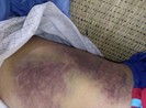 Con đánh cha bầm người, mẻ bánh chè?