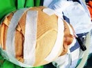 Nghệ An: Bé 5 tuổi bị chó đẻ cắn rách da đầu, lộ xương sọ