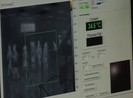 Dịch Ebola diễn biến bất thường, khó kiểm soát