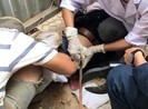 Người đàn ông bị thanh sắt rơi từ trên cao đâm xuyên bụng