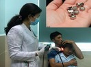 Nhét pin điện tử vào tai, bé trai năm tuổi thủng màng nhĩ