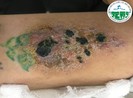 7 nguy cơ cần phải biết trước khi quyết định xăm mình
