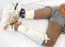 Nguy cơ đoạn 2 chân vì rắn cắn 1 chân, đi hút máu độc 2 chân