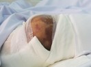 Uống thuốc truyền miệng, bệnh nhân tiểu đường mất mạng