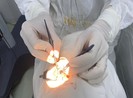 TP.HCM: Bác sĩ đến nhà nhận hai giác mạc của người hiến tặng