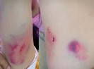 Không khởi tố vụ chánh văn phòng Huyện ủy đánh người