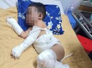 Bình Dương: 1 gia đình bị ném bom xăng, 2 bé trai bỏng nặng