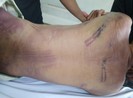1 phạm nhân tử vong trong trại giam