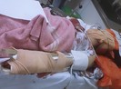 Đi nhậu về rồi chém người yêu trọng thương