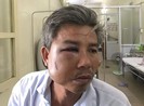 Nhân viên Trung tâm công viên cây xanh bị đánh nhập viện