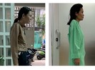 Căn bệnh khiến cô gái 30 tuổi bị còng như 60 tuổi