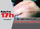 Bản tin 17h:Đề nghị khởi tố vụ nữ luật sư bị đánh ở tòa