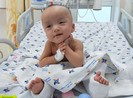 25 ngày sau ca mổ tách dính, cặp song Nhi đã tự ngồi dậy