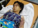 Diễn biến tố tụng mới vụ cô gái 18 tuổi bị đánh đến sẩy thai