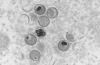 Hình chụp kính hiển vi điện tử cho thấy mặt cắt siêu mỏng của virus đậu mùa khỉ.