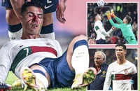 Khuôn mặt đẫm máu của Cristiano Ronaldo