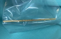 Nuốt tăm tre 10cm, người đàn ông bị đâm thủng đại tràng