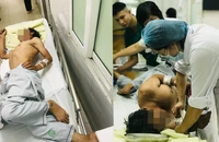 3 ca bệnh uốn ván nặng, nguy cơ tử vong cao chỉ trong 2 tuần