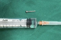 Cô gái bị chiếc khuyên đeo ở lưỡi rơi xuống dạ dày trong khi ăn