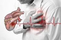 Các dấu hiệu cảnh báo ngừng tim đột ngột